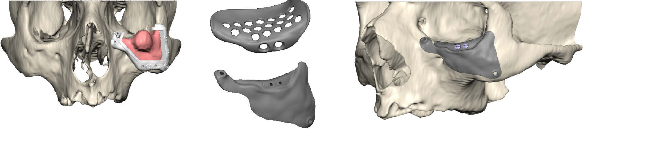 orbita